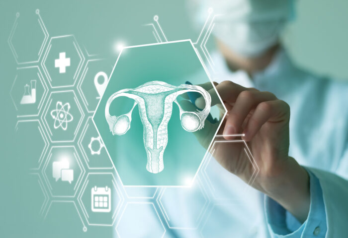 Cáncer de endometrio: Nuevas perspectivas sobre su manejo y las últimas actualizaciones clínicas.